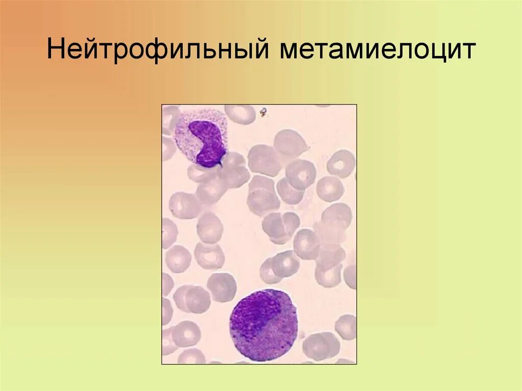 Метамиелоциты. Нейтрофильный миелоцит. метамиелоцит нейтрофильный морфология. нейтрофилы метамиелоциты. метамиелоцит базофильный морфология.