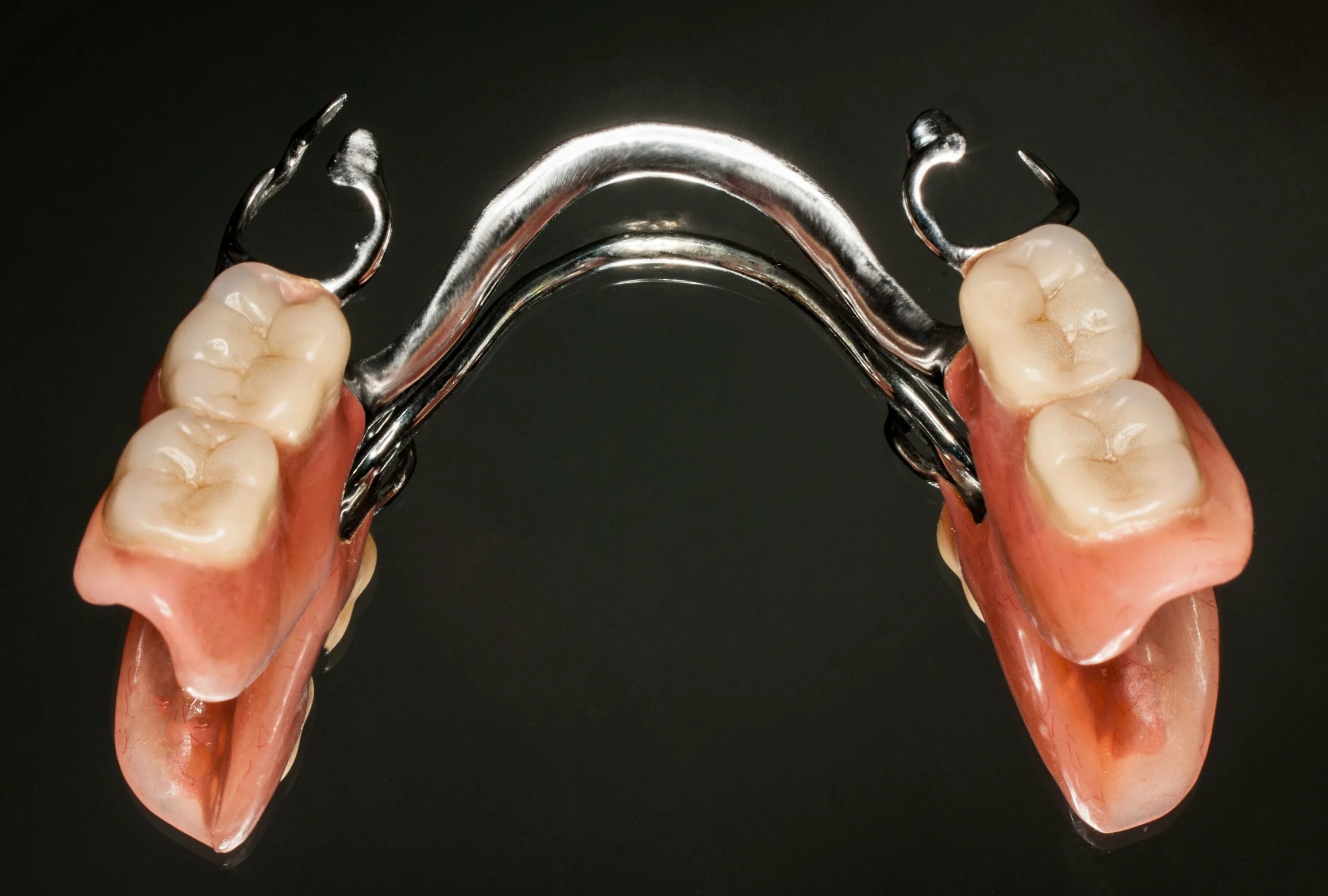 Снимать ли зубные протезы на ночь. Бюгельный протез а16.07.036.001. Что такое бюгельный протез в стоматологии. Бюгельный протез ч аттачме6ами. Бюгельный протез а16.07.036.002.
