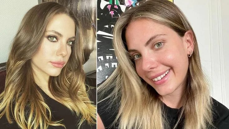 Afili Aşk’ın Ayşe’si Burcu Özberk meğer estetik harikasıymış! Eski hali şok etti