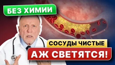 Неумывакин сосуды
