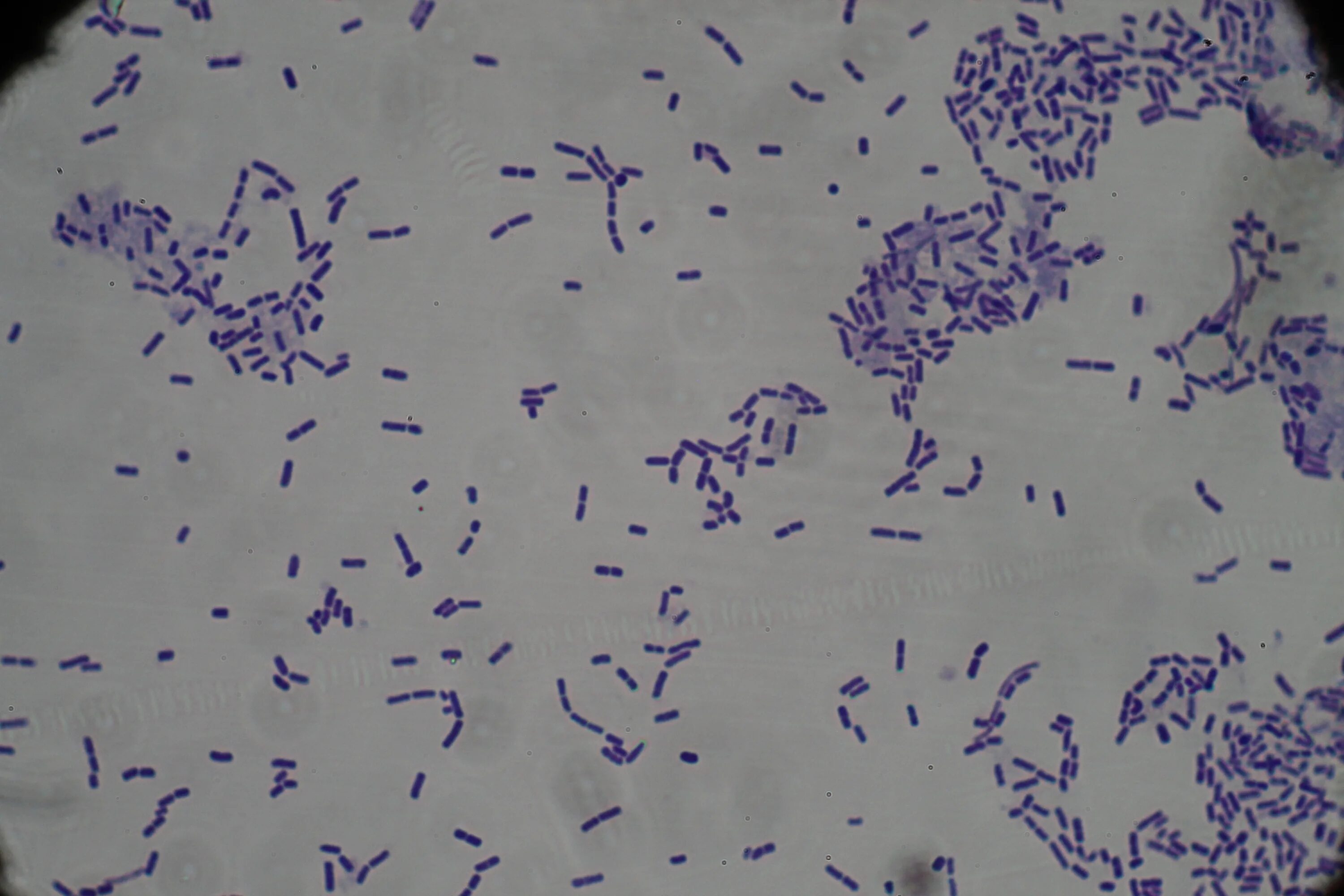 Clostridium spp. Клостридиум перфрингенс микроскопия. Клостридии перфрингенс микробиология. Клостридии перфрингенс микроскопия. Клотсридиум перфингеус.