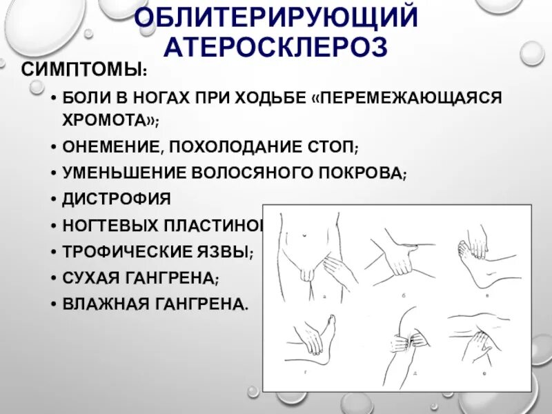 Облитерирующий атеросклероз сосудов нижних мкб. Облитерирующий атеросклероз. облитерирующий атеросклероз симптомы. облитерирующий атеросклероз нижних конечностей симптомы. облитерирующим атеросклерозом болеют:.