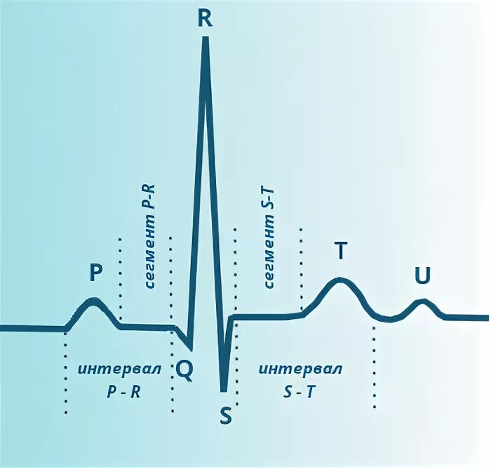 зубец u на экг u. экг зубец r в v5-6 высота. волна u на экг. зубец u на экг. синусовый ритм на экг.