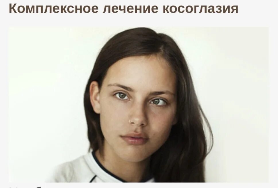 Моффи гаторн харди. Косоглазие у женщин. Билл скарсгард актер. Косые глаза. Сходящееся косоглазие.