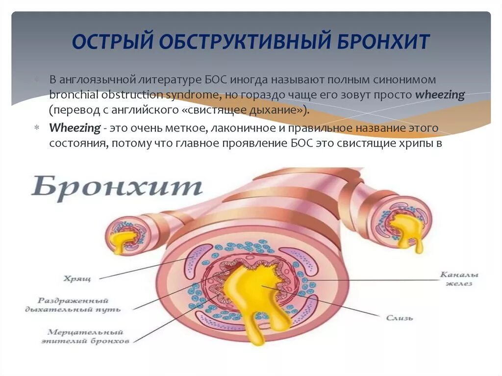 Причины частых бронхитов. Бронхит с обструкцией. Острый необструктивный бронхит. Обструктивный бронхит у детей. Обструктивный бронхиолит.