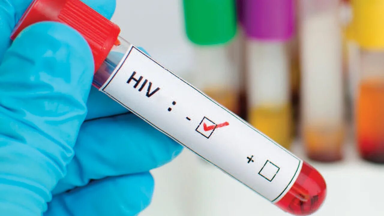 Virus testing. ВИЧ. ВИЧ пробирка. Шприц для ВИЧ инфицированных. ВИЧ картинки.