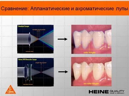 Степени коррекции
