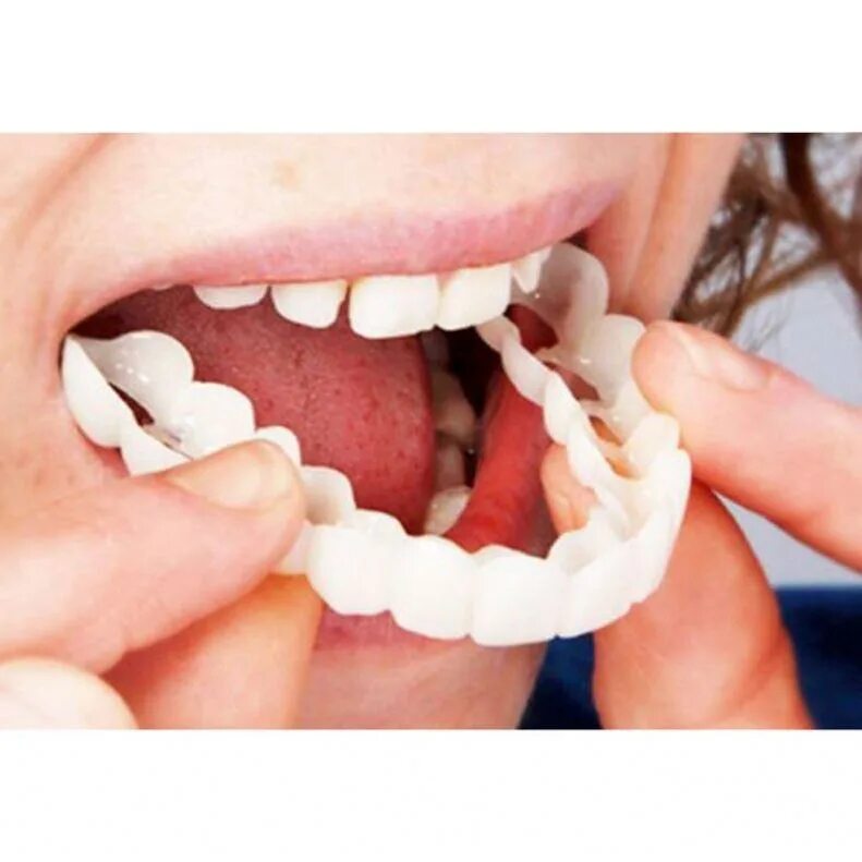 Какие зубы лучше вставлять. Виниры snap on smile. накладные зубы snap on smile. виниры-элайнеры snap-on smile.