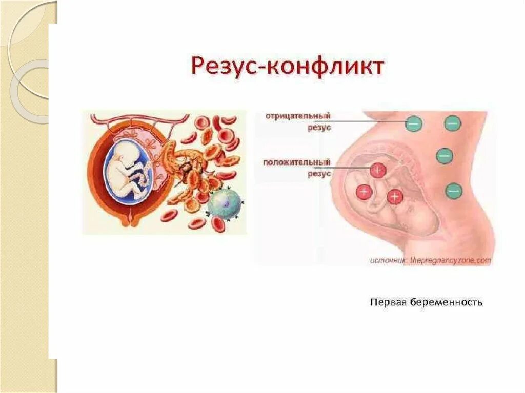 Резус фактор и резус конфликт. Резус-конфликт матери и плода. Условия возникновения резус конфликта. Резус конфликт беременность. Кровь несовместимость резусов