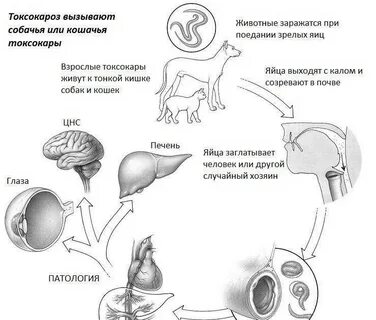 Лечение токсокароза человека