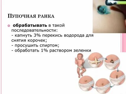 Обработка пупочной ранки при омфалите алгоритм