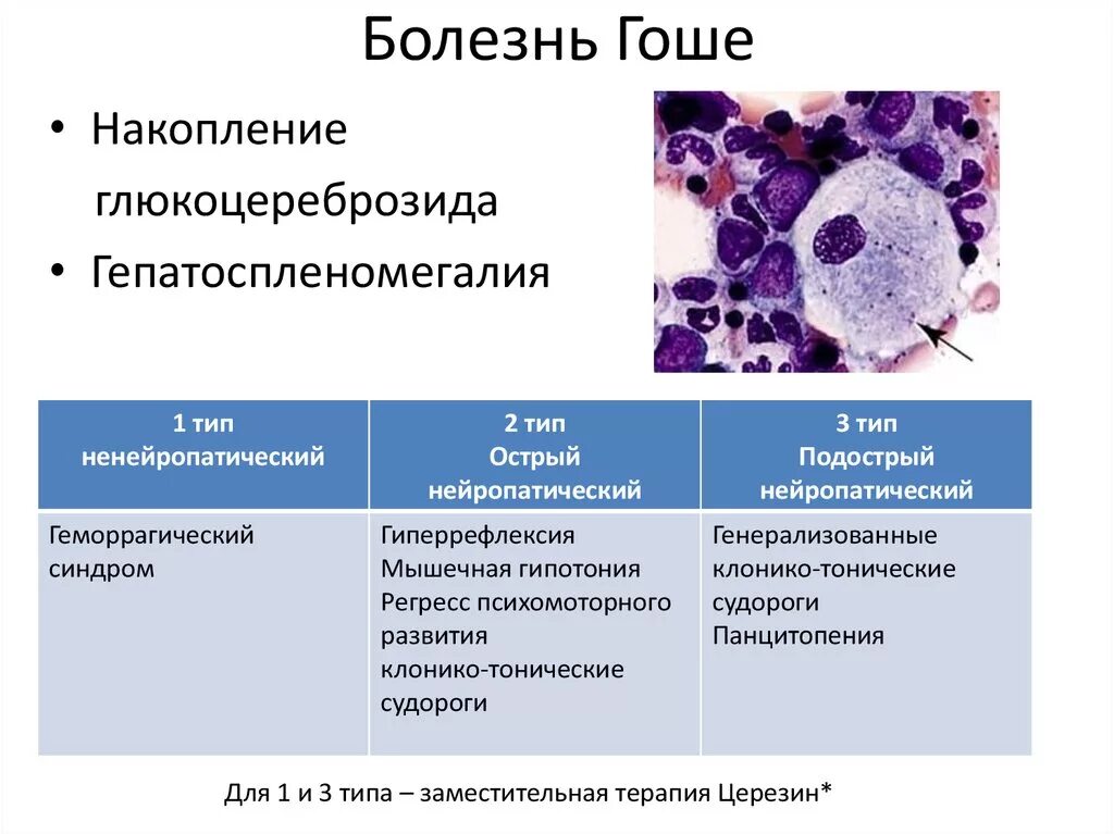 Макрофаги 4. Болезнь Гоше 1 типа клинические проявления. Болезнь Гоше клинические проявления. Болезнь Гоше диагностика клинические рекомендации.