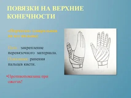 Повязки на верхнюю конечность