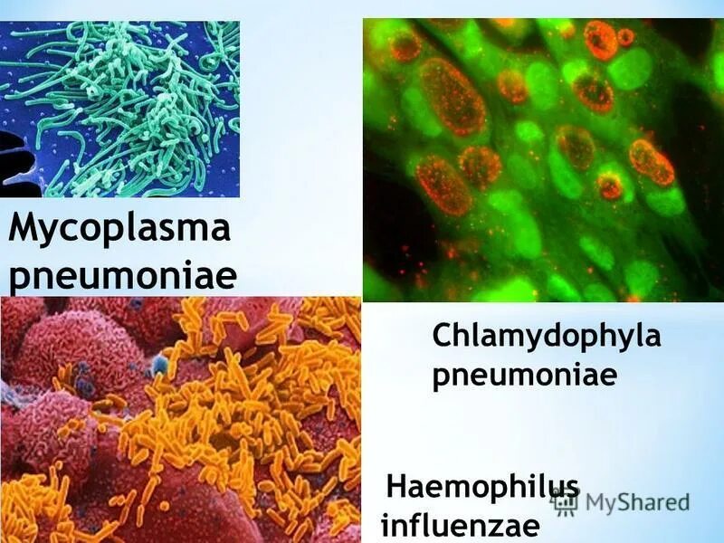 проявления хламидийной пневмонии. Chlamydia pneumoniae микробиология. хламидиозная атипичная пневмония. Igg igm расшифровка микоплазма пневмонии. антитела igg микоплазма пневмония.