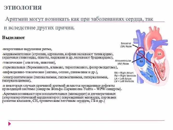 Операция рча отзывы пациентов. Аритмия сердца операция прижигание. Операции при нарушении ритма сердца. Операция по прижиганию аритмии сердца. Прижигание сердца при аритмии.