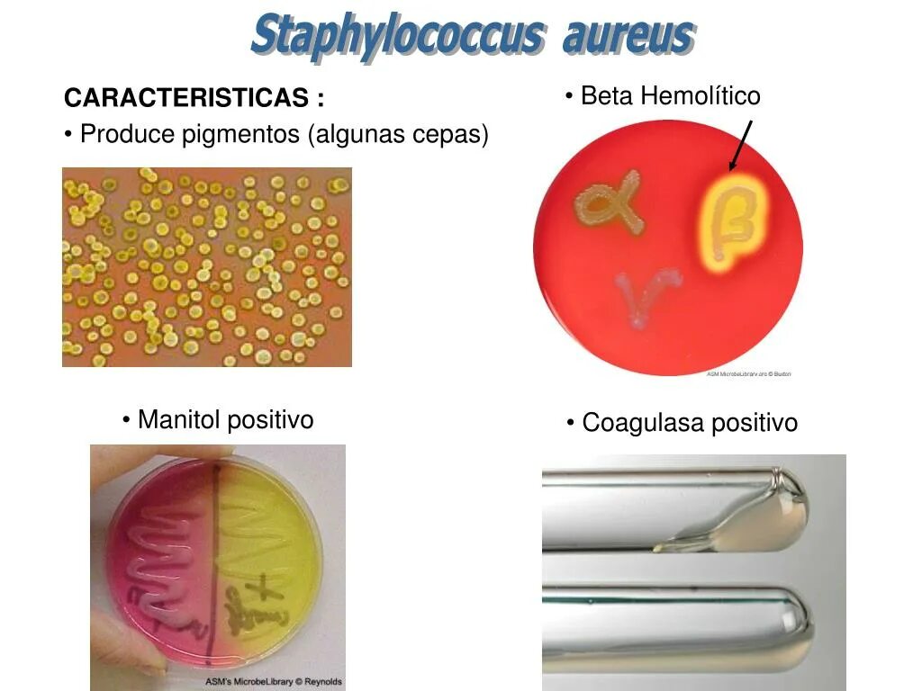 Стафилококк aureus в носу. Золотистый стафилококк бета.