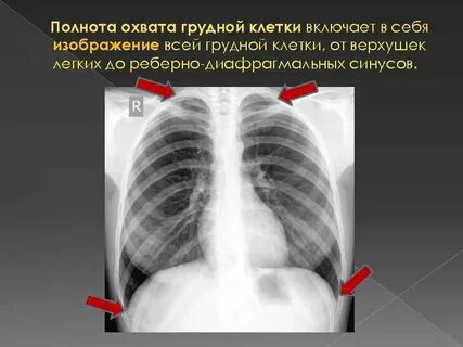 Полнота охвата
