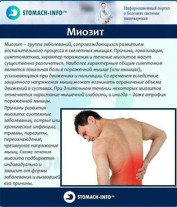 Миозит что это. Воспаление мышц миозит. Симптомы миозита мышц поясницы. Воспаление мышц спины миозит.