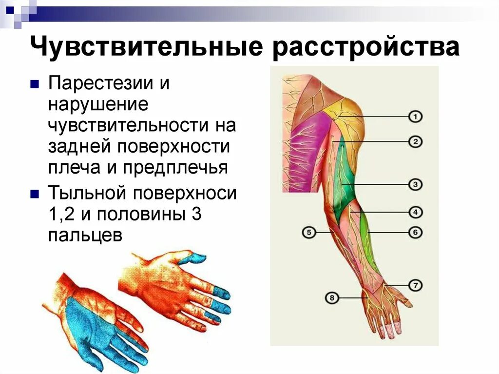 Поражение нервов руки. Локтевой нерв чувствительная иннервация. Иннервация локтевого и лучевого нерва. Зона чувствительной иннервации лучевого нерва. Чувствительные расстройства локтевого нерва.