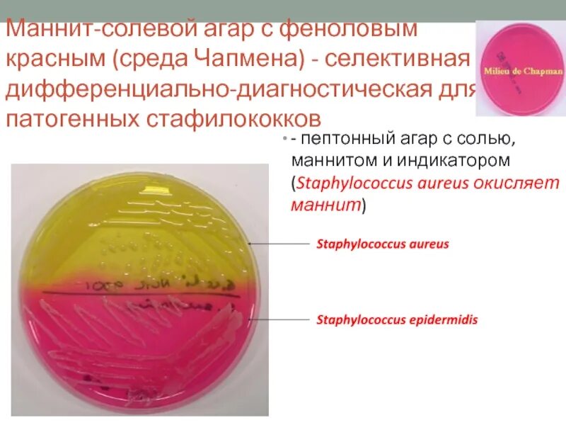 Маннит солевой агар стафилококк. Маннит-солевой агар для Staphylococcus. Маннит солевой агар. Среда с маннитом для стафилококков. Staphylococcus aureus среда