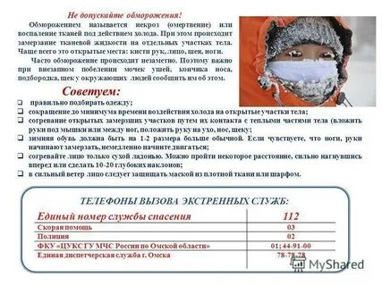 Температура мерзнут конечности