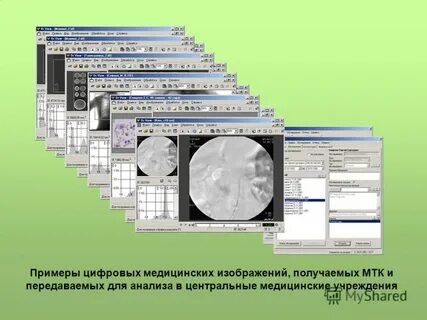 Методы анализа медицинских изображений