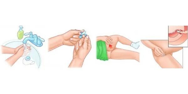 Глицерин свечи. Глицериновые суппозитории нижфарм. Глицериновые свечи для новорожденных. Как вставить свечу с глицерином. Свечи ректальные глицериновые.