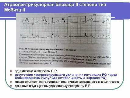 Выпадение комплекса