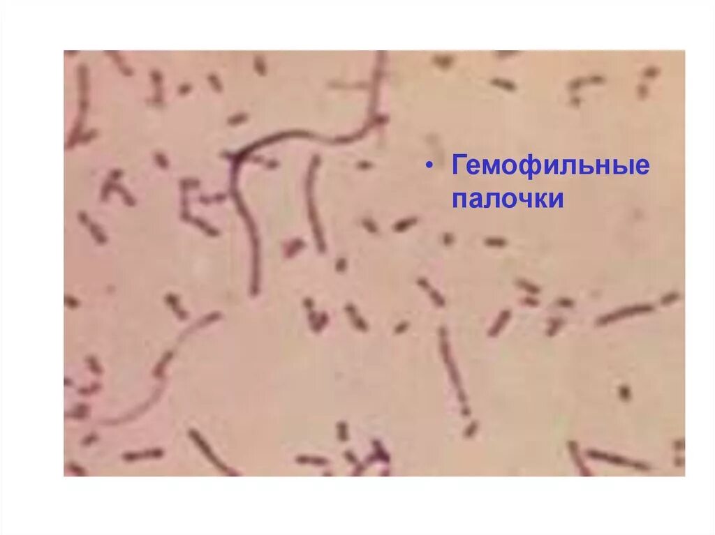 Гемофильная палочка микроскопия. Haemophilus influenzae (гемофильная палочка). Гемофильная палочка под микроскопом. Haemophilus influenzae морфология. Haemophilus influenzae в носу