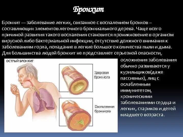 Опасное заболевание легких