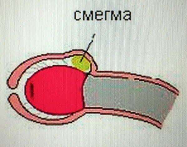 Тип Полового Члена