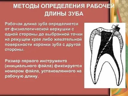 Определение рабочей длины
