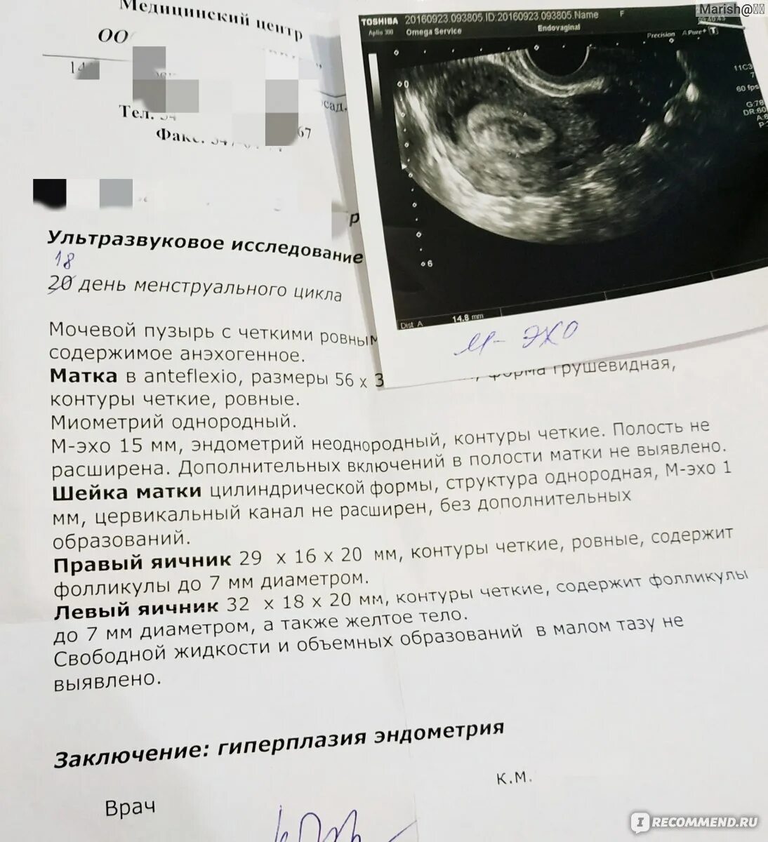 При задержке какое делают узи. Трансвагинальное узи беременность. трансвагинальное узи матки. трансвагинальное узи на 5 неделе беременности.