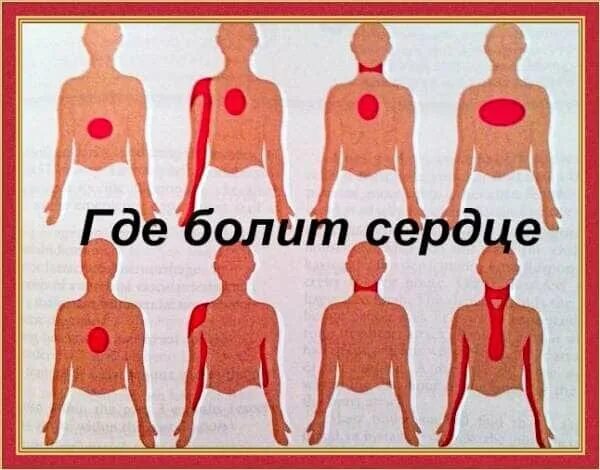 Куда именно. Где болит сердце. Локализация боли в сердце. Где может болеть сердце.