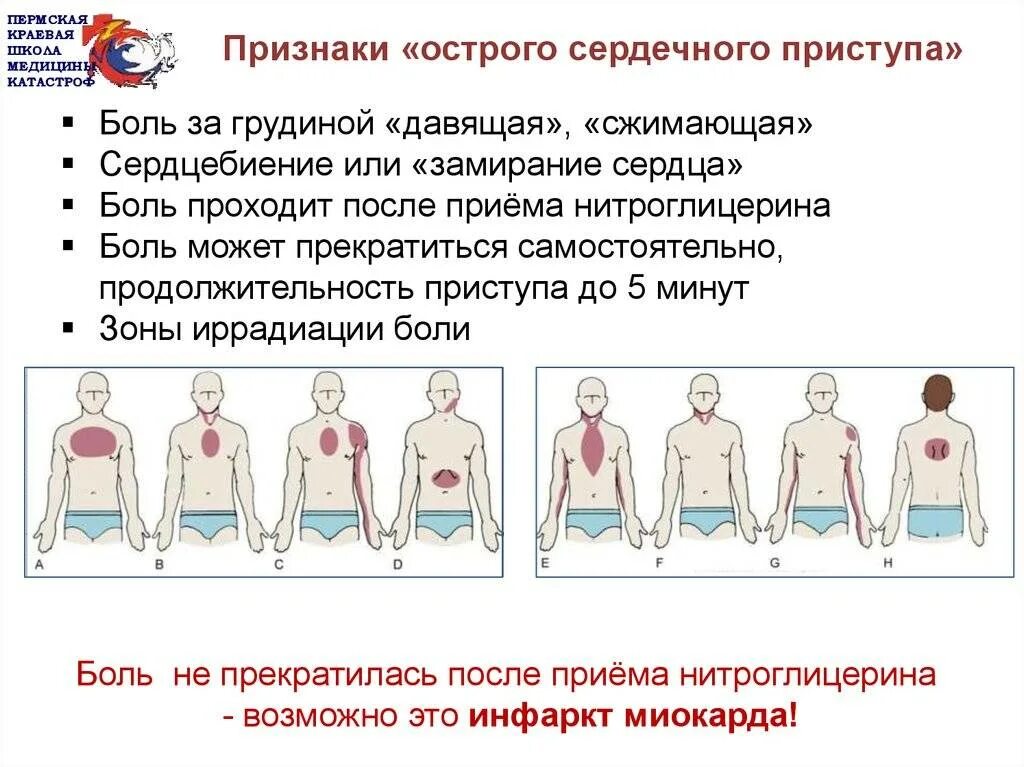 Симптом иррадиации. Боль в грудной клетке. Причины болезненности грудной клетки. Боль в грудной клетке посередине.