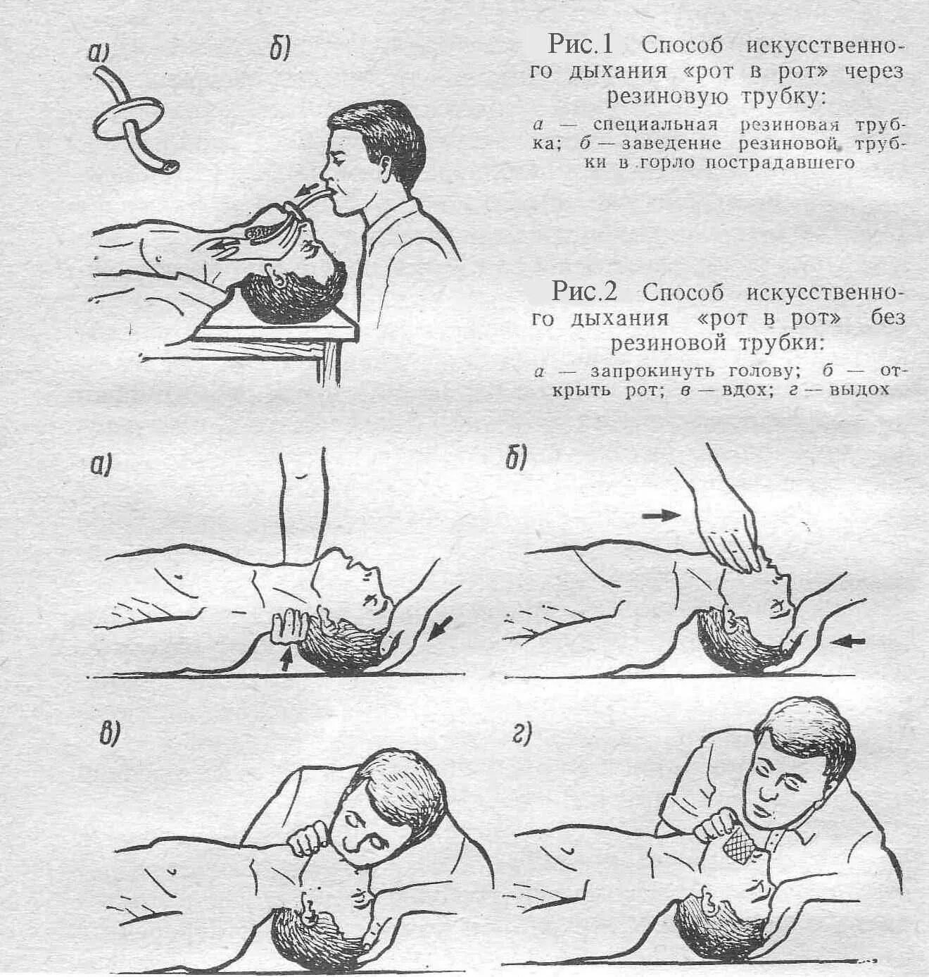 Приемы искусственного дыхания. Схема оказания искусственного дыхания. Искусственное дыхание способы схема. Схема приемов искусственного дыхания. Схему выполнения искусственного дыхания..