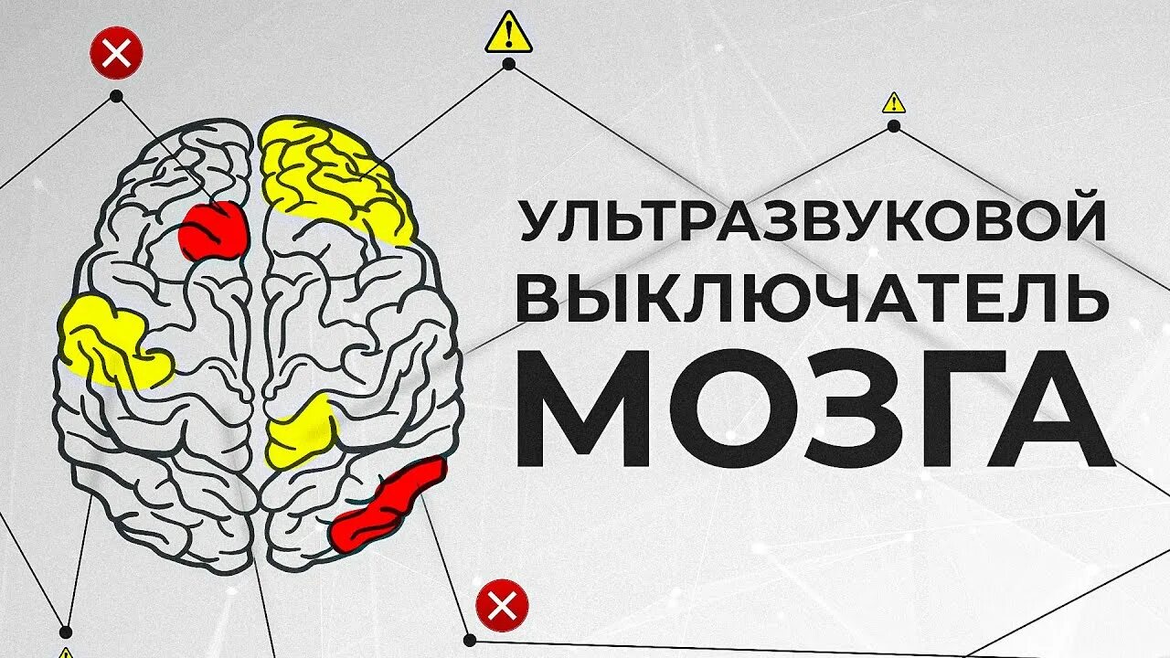 Мозг выключен. Отключить мозг. Мозг отключился. Выключатель мозга.