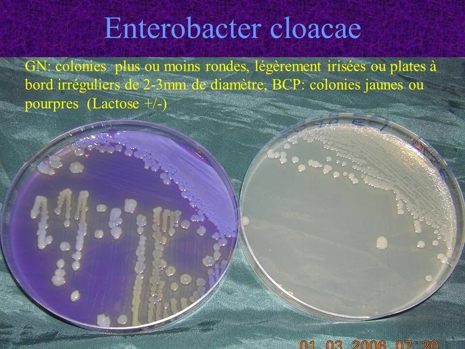 Enterobacter cloacae под микроскопом. Enterobacter cloacae в моче. Энтеробактер на среде Эндо. Микроорганизмы энтеробактер. Enterobacter cloacae что это