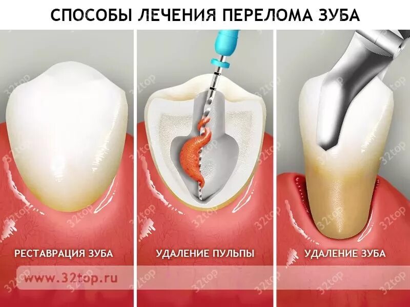 Можно на корни поставить зубы. Можно на корни поставить зубы