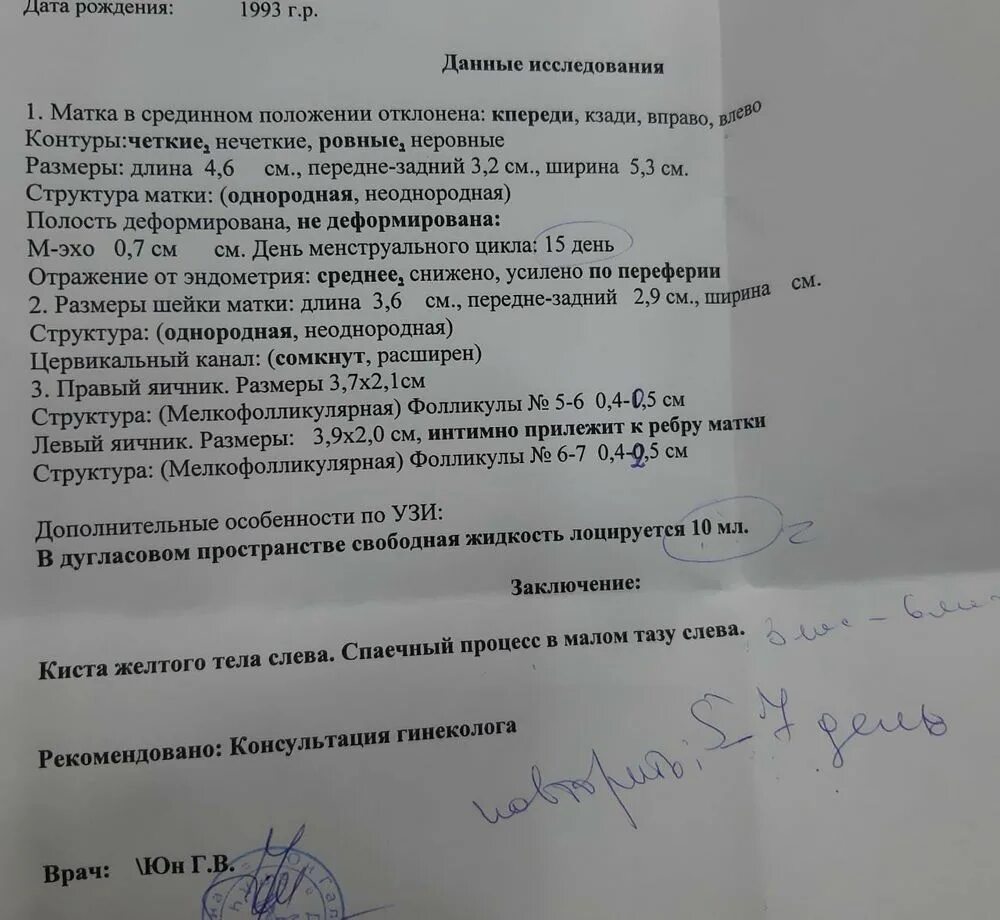 Почему тянет левый яичник. Положение яичника у ребра матки. яичник расположен у ребра матки.