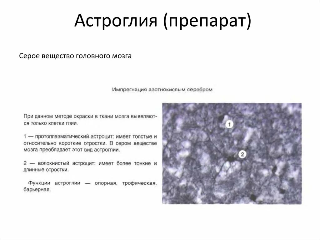 Клетки кахаля гистология. Астроглия и микроглия. Астроциты функции гистология. Отростки астроглиоцитов. Типы клеток в нервной системе.