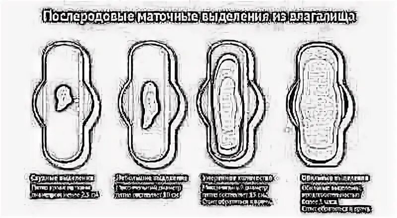 Выделения после кесарева норма