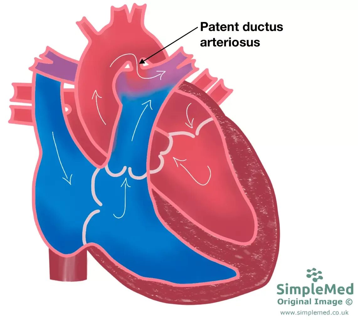 Plexus arteriosus