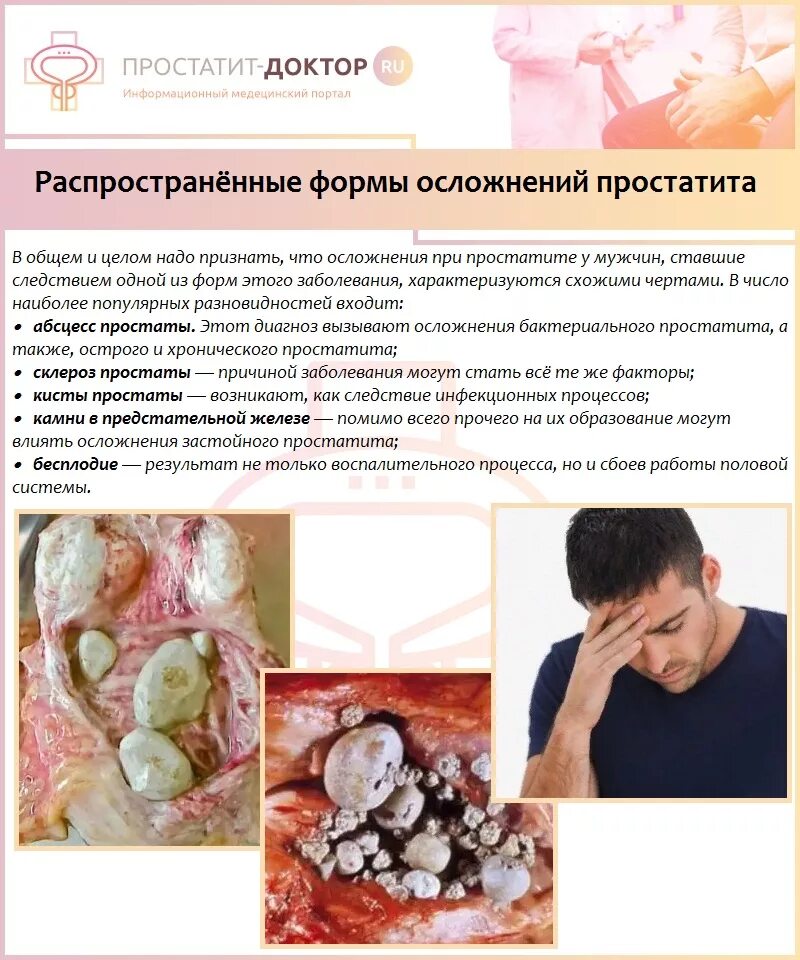 Простатит у молодых. Хронический простатит. симптомы при воспалении простаты у мужчин.
