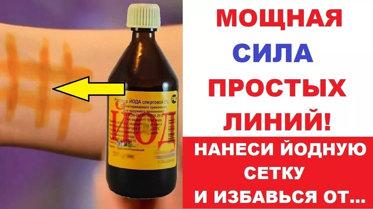 Можно ли делать йодовую сетку при температуре
