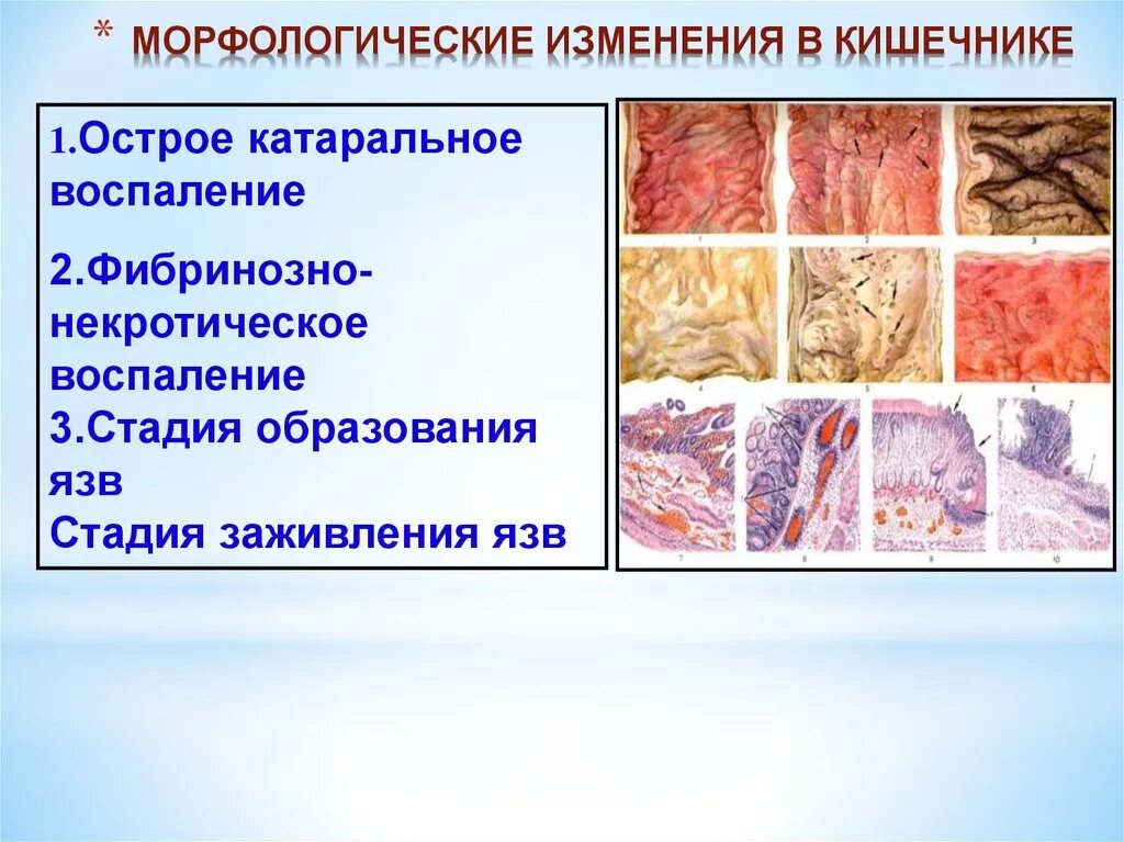 Морфологические изменения организма это. Морфологические изменения. Сальмонеллез морфологические изменения. Морфические изменения. Сальмонеллез презентация.