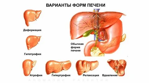 Виды печени