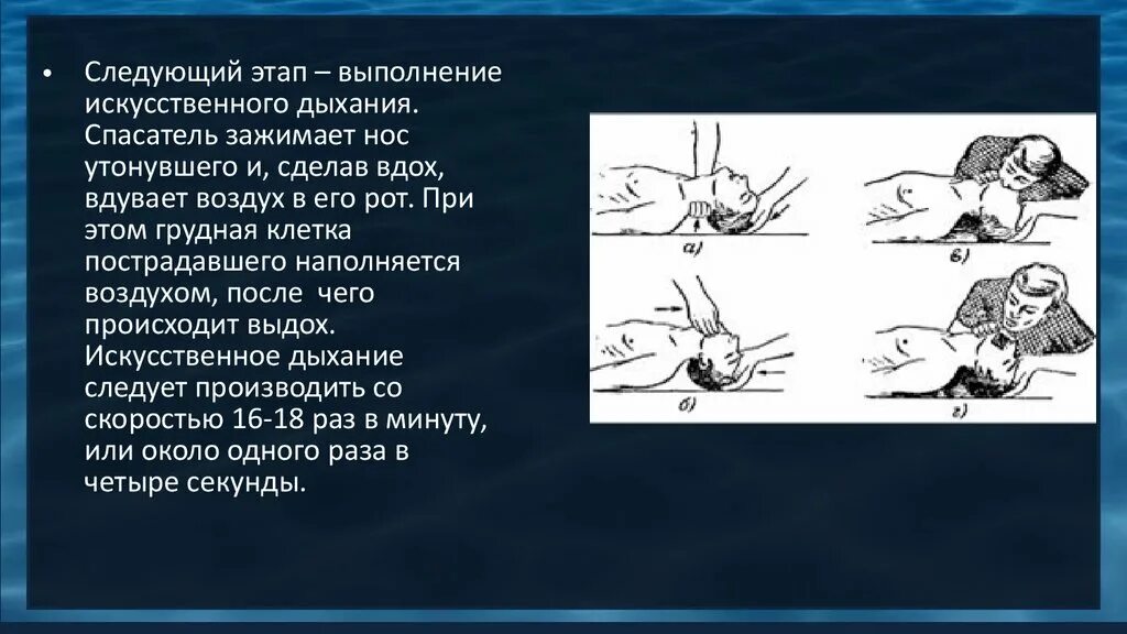 Искусственное дыхание проводится в следующих случаях. Непрямой массаж сердца при утоплении. Порядок искусственного дыхания при утоплении. Искусственное дыхание утопленнику. Искусственное дыхание и непрямой массаж сердца при утоплении.