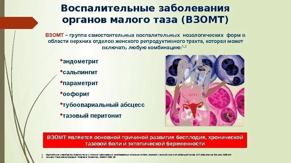 Воспалительные заболевания помощь. Воспалительные заболевания женских.половых органов. воспалительные заболевания малого таза (взомт). воспалительные заболевания женских органов гинекология. воспалительное заболевание органа.