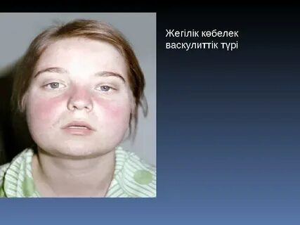 Үшінші триместрдегі жүкті әйелдердің жыныстық позициялары